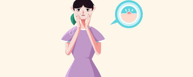 痤疮总是反反复复怎么办 痤疮反复发作吃什么